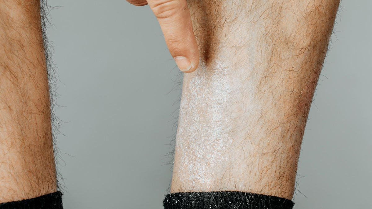 10-causes-of-itchy-legs-and-how-to-deal-with-it-itchy-legs-itchy